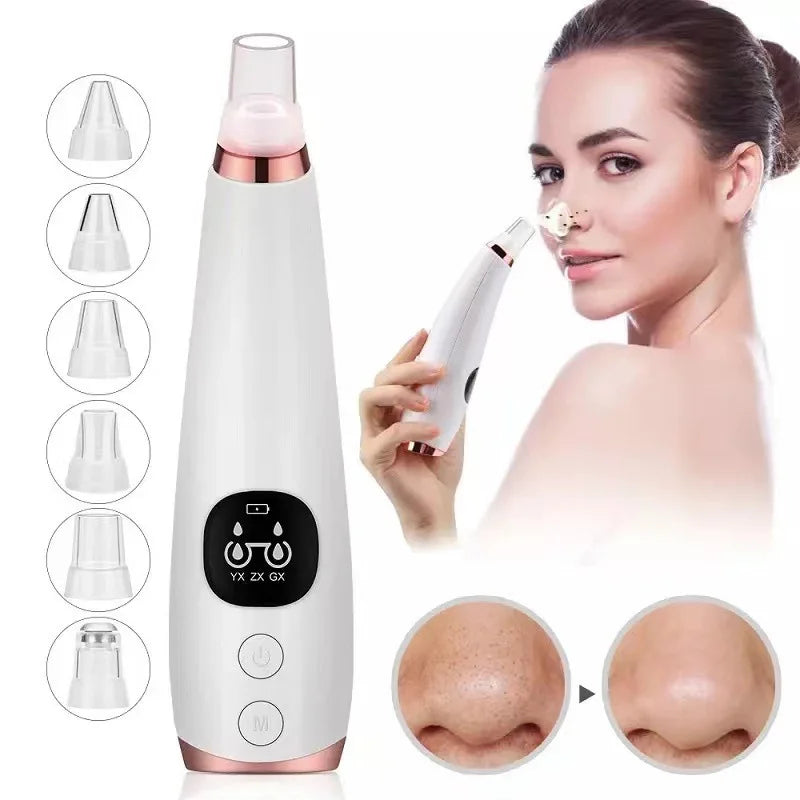 Electric Blackhead Remover Vacuum