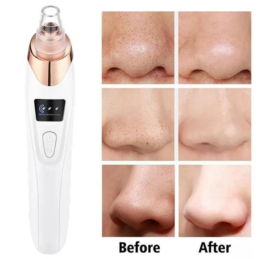 Electric Blackhead Remover Vacuum  Cleaner